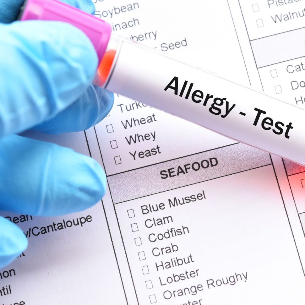 Ujian Darah Alergik atau Allergy Blood Test di Nur Mediklinik, Tawau Sabah