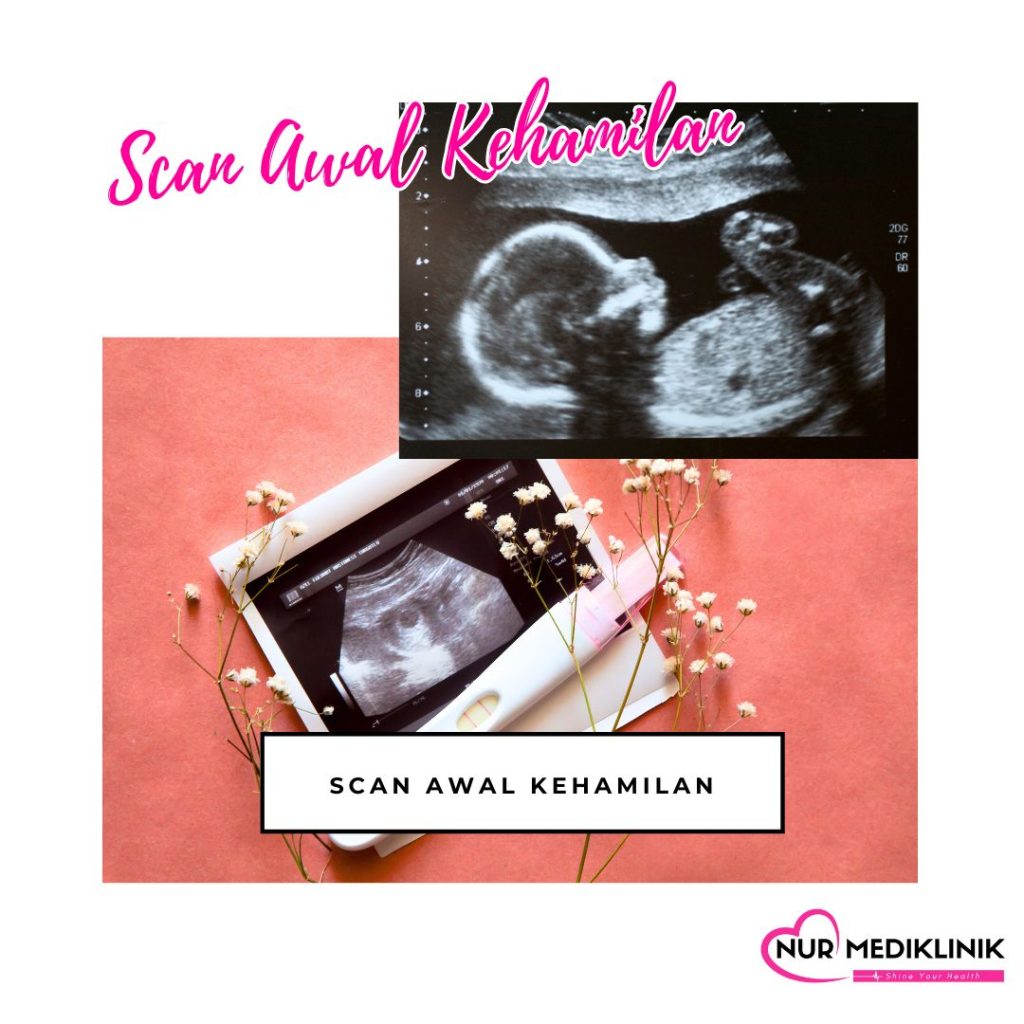 Klinik Scan Baby Di Tawau Murah & Jelas | Klinik Di Tawau | Klinik Doktor Perempuan | Harga Scan Awal Kehamilan | Confirmation Scan Baby Tawau