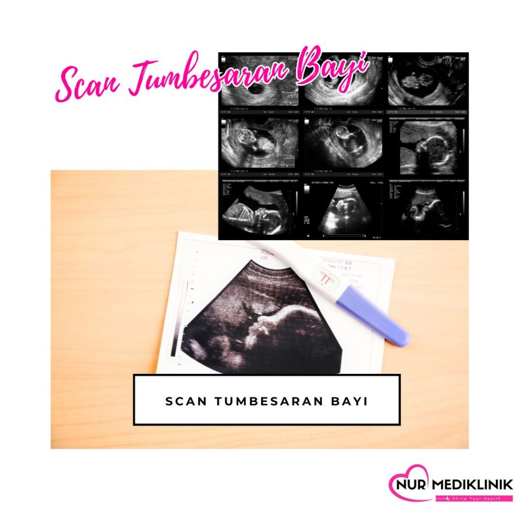 Klinik Scan Baby Tawau Murah & Jelas | Klinik Scan Baby Near Me | Klinik Di Tawau | Klinik Swasta Tawau | Klinik Ibu Anak Swasta Tawau | Klinik Doktor Perempuan Tawau | Harga Scan Tumbesaran Bayi | Growth Scan Tawau
