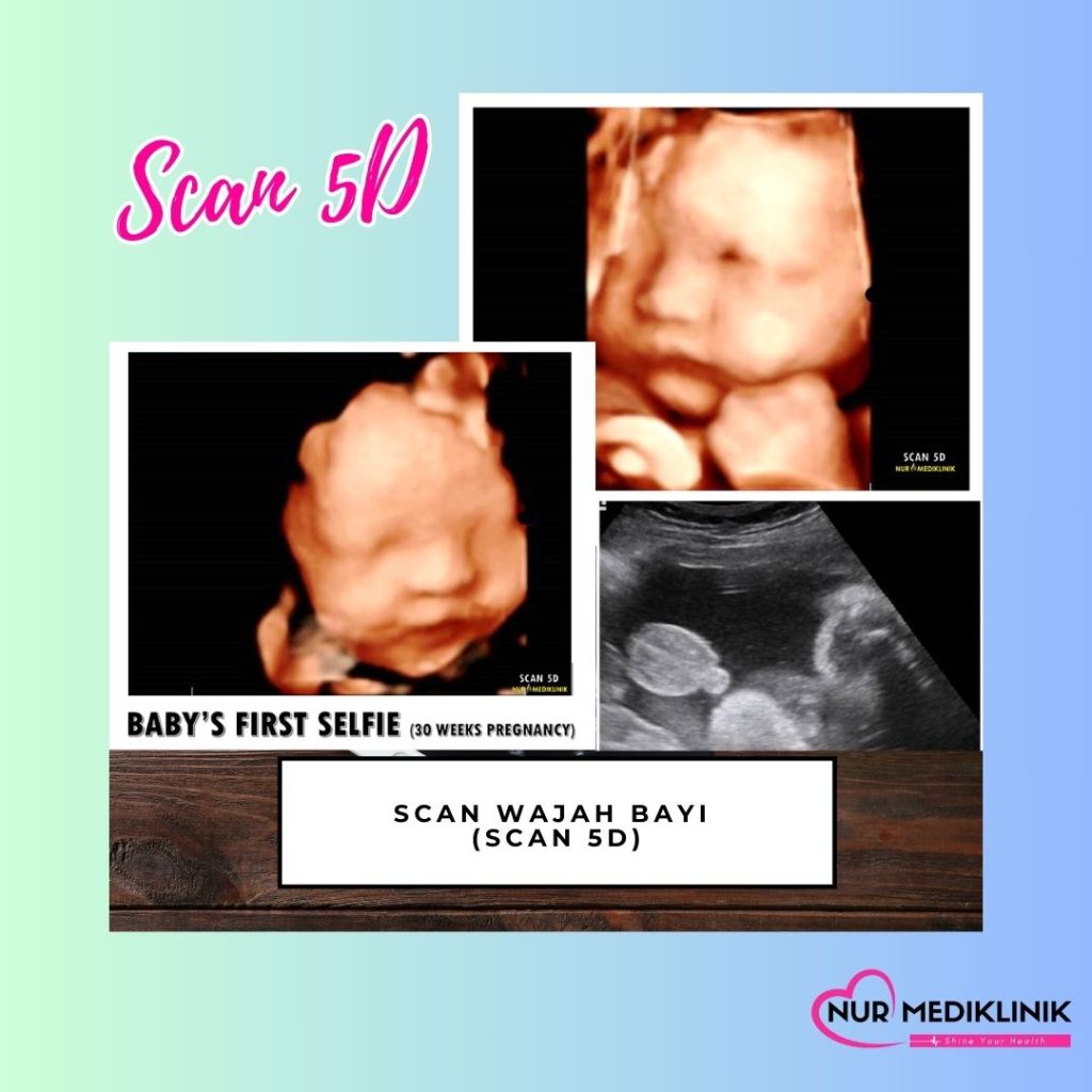Klinik Scan Baby Tawau Murah & Jelas | Klinik Scan Baby Near Me | Klinik Di Tawau | Klinik Swasta Tawau | Klinik Ibu Anak Swasta Tawau | Klinik Doktor Perempuan Tawau | Harga Scan 5D Bayi Tawau